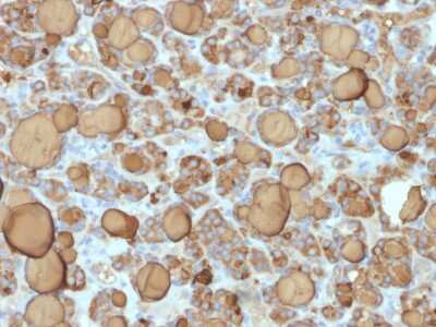 Immunohistochemistry-Paraffin: Thyroglobulin Antibody (TGB/1968R) - Azide and BSA Free [NBP3-08269]