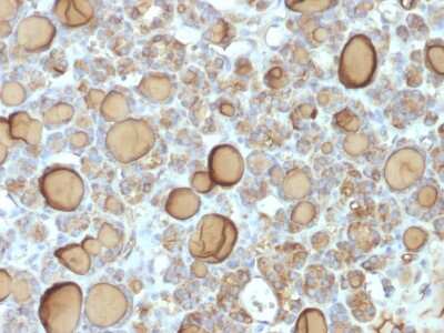 Immunohistochemistry-Paraffin: Thyroglobulin Antibody (TGB/1970R) - Azide and BSA Free [NBP3-08265]