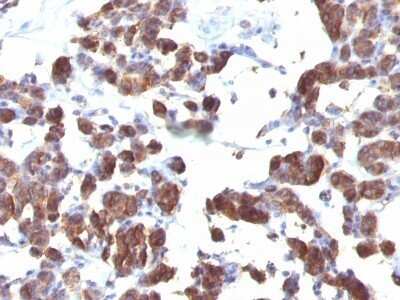 Immunohistochemistry-Paraffin: Thyroglobulin Antibody (TGB04 + TGB05) - Azide and BSA Free [NBP2-34724]