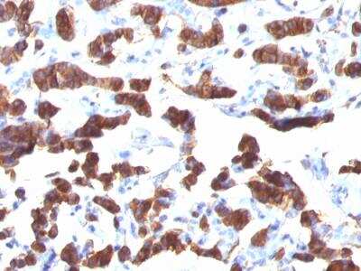 Immunohistochemistry-Paraffin: Thyroglobulin Antibody (TGB24) - IHC-Prediluted [NBP2-48468]