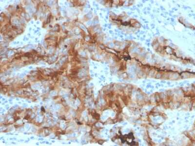 Immunohistochemistry-Paraffin: Thyroglobulin Antibody (rTGB/4744) - Azide and BSA Free [NBP3-08264]