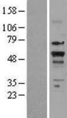 Western Blot: TR beta 1/NR1A2/Thyroid Hormone Receptor beta Overexpression Lysate [NBL1-16896]