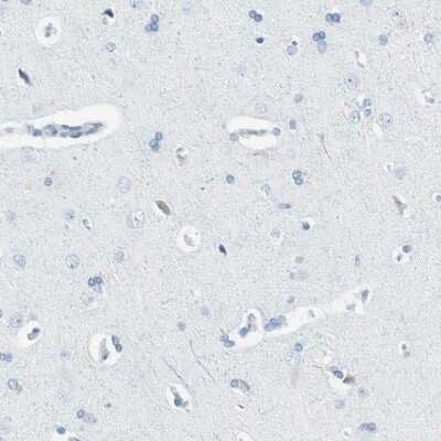 Immunohistochemistry-Paraffin: Thyroid Peroxidase Antibody [NBP1-80670]