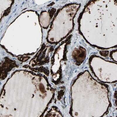 Immunohistochemistry-Paraffin: Thyroid Peroxidase Antibody [NBP1-80670]
