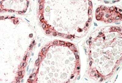 Immunohistochemistry-Paraffin: Thyroid Peroxidase Antibody [NBP1-97765]