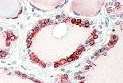 Immunohistochemistry-Paraffin: Thyroid Peroxidase Antibody [NBP2-27544]