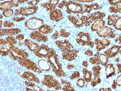 Immunohistochemistry-Paraffin: Thyroid Peroxidase Antibody (TPO/1922) - Azide and BSA Free [NBP2-79923]