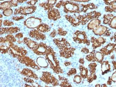 Immunohistochemistry-Paraffin: Thyroid Peroxidase Antibody (TPO/1922) [NBP2-79789]