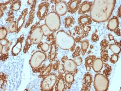 Immunohistochemistry-Paraffin: Thyroid Peroxidase Antibody (TPO/3813R) - Azide and BSA Free [NBP3-08761]