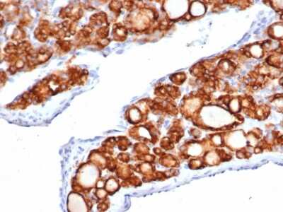 Immunohistochemistry-Paraffin: Thyroid Peroxidase Antibody (TPO/6417R) - Azide and BSA Free [NBP3-08762]