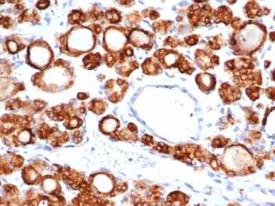 Immunohistochemistry-Paraffin: Thyroid Peroxidase Antibody (TPO/6417R) - Azide and BSA Free [NBP3-08762]