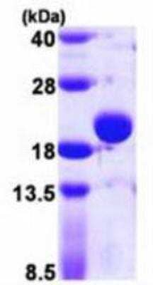SDS-PAGE: Recombinant E. coli Thiol Peroxidase His Protein [NBP1-78805]