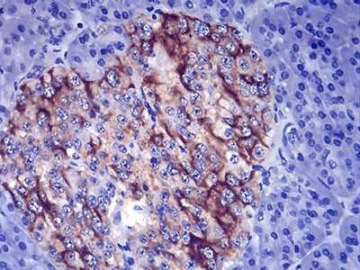 Immunohistochemistry-Paraffin: TSH beta Antibody (1D12G1) - BSA Free [NBP2-52574]