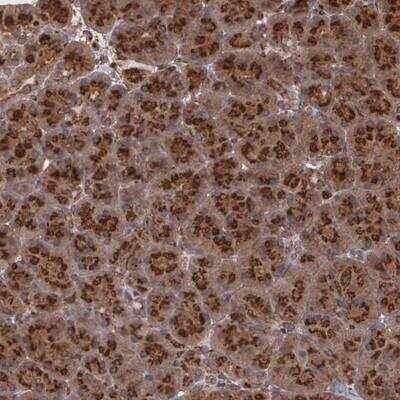 Immunohistochemistry-Paraffin: Thyroid receptor-interacting protein 11 Antibody [NBP1-84534]