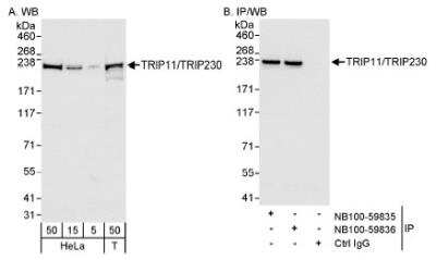 Western Blot: Thyroid receptor-interacting protein 11 Antibody [NB100-59836]