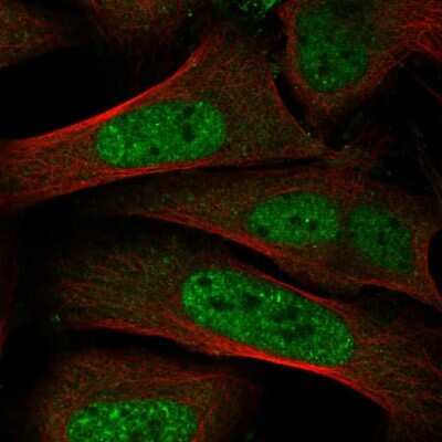 Immunocytochemistry/ Immunofluorescence: Thyroid receptor-interacting protein 12 Antibody [NBP2-34035]