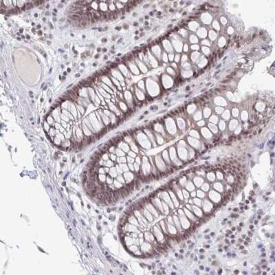 Immunohistochemistry: Thyroid receptor-interacting protein 12 Antibody [NBP2-33450]