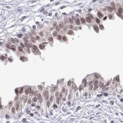 Immunohistochemistry: Thyroid receptor-interacting protein 12 Antibody [NBP2-33450]
