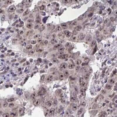 Immunohistochemistry: Thyroid receptor-interacting protein 12 Antibody [NBP2-33450]