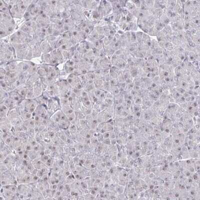 Immunohistochemistry-Paraffin: Thyroid receptor-interacting protein 12 Antibody [NBP2-33450]