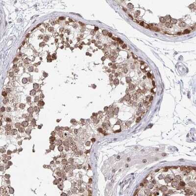 Immunohistochemistry-Paraffin: Thyroid receptor-interacting protein 12 Antibody [NBP2-33450]