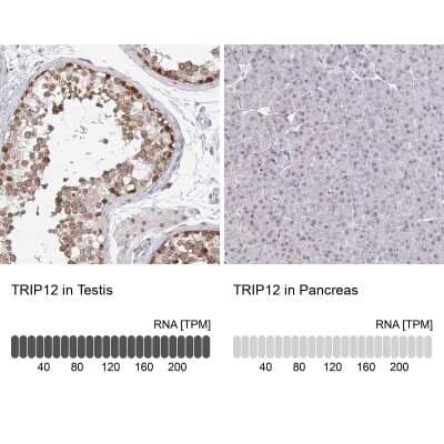 Immunohistochemistry-Paraffin: Thyroid receptor-interacting protein 12 Antibody [NBP2-33450]