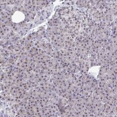 Immunohistochemistry-Paraffin: Thyroid receptor-interacting protein 12 Antibody [NBP2-34035]