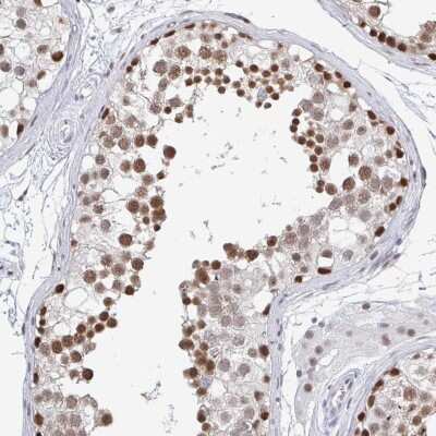 Immunohistochemistry-Paraffin: Thyroid receptor-interacting protein 12 Antibody [NBP2-34035]