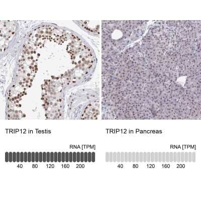 Immunohistochemistry-Paraffin: Thyroid receptor-interacting protein 12 Antibody [NBP2-34035]