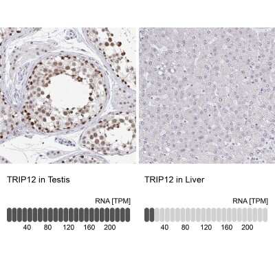Immunohistochemistry-Paraffin: Thyroid receptor-interacting protein 12 Antibody [NBP2-34035]
