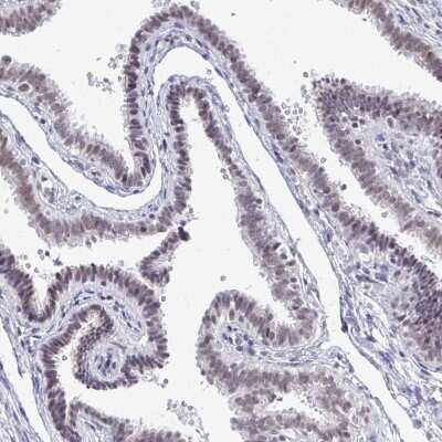 Immunohistochemistry-Paraffin: Thyroid receptor-interacting protein 12 Antibody [NBP2-34035]
