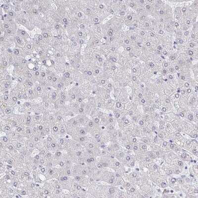 Immunohistochemistry-Paraffin: Thyroid receptor-interacting protein 12 Antibody [NBP2-34035]