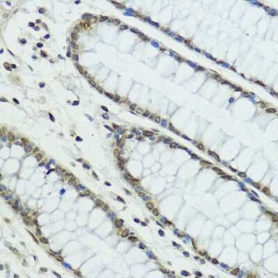 Immunohistochemistry-Paraffin: Thyroid receptor-interacting protein 12 Antibody - BSA Free [NBP2-94325]