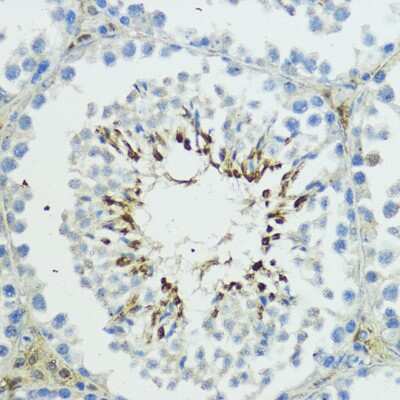 Immunohistochemistry-Paraffin: Thyroid receptor-interacting protein 12 Antibody - BSA Free [NBP2-94325]