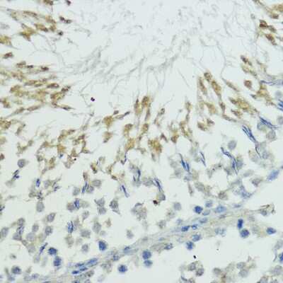 Immunohistochemistry-Paraffin: Thyroid receptor-interacting protein 12 Antibody - BSA Free [NBP2-94325]