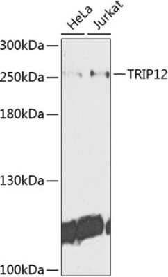 Western Blot: Thyroid receptor-interacting protein 12 AntibodyBSA Free [NBP2-94325]