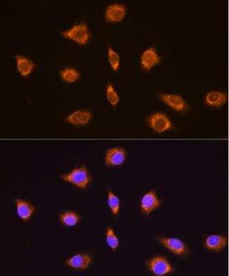 Immunocytochemistry/ Immunofluorescence: Thyrotropin Releasing Hormone Antibody - Azide and BSA Free [NBP2-94348]