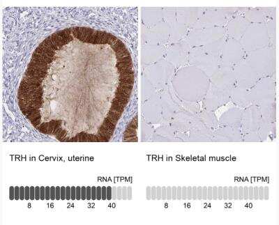 Immunohistochemistry-Paraffin: Thyrotropin Releasing Hormone Antibody [NBP2-34014]