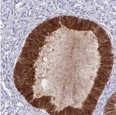Immunohistochemistry-Paraffin: Thyrotropin Releasing Hormone Antibody [NBP2-34014]