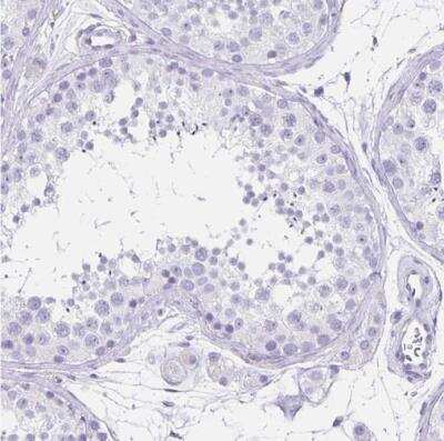 Immunohistochemistry-Paraffin: Thyrotropin Releasing Hormone Antibody [NBP2-34014]