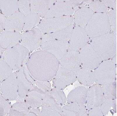 Immunohistochemistry-Paraffin: Thyrotropin Releasing Hormone Antibody [NBP2-34014]