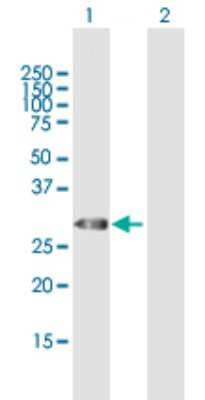 Western Blot: Thyrotropin Releasing Hormone Antibody [H00007200-B01P]