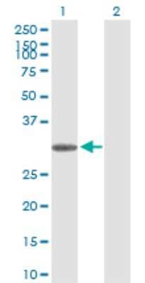 Western Blot: Thyrotropin Releasing Hormone Antibody [H00007200-D01P]