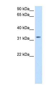 Western Blot: Thyrotropin Releasing Hormone Antibody [NBP1-79963]