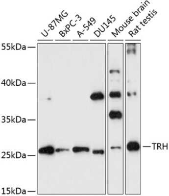 Western Blot: Thyrotropin Releasing Hormone AntibodyAzide and BSA Free [NBP2-94348]