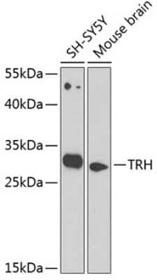 Western Blot: Thyrotropin Releasing Hormone AntibodyAzide and BSA Free [NBP2-95244]