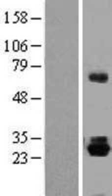 Western Blot: Thyrotropin Releasing Hormone Overexpression Lysate [NBP2-10383]