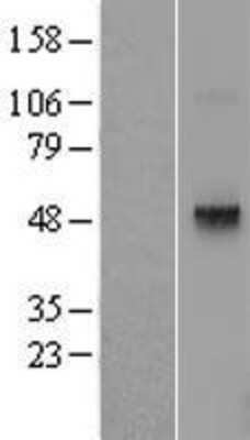 Western Blot: TRHR Overexpression Lysate [NBL1-17269]