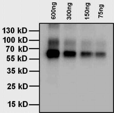Western Blot: Thyroxine Antibody (T4YCH) [NBP1-78604]