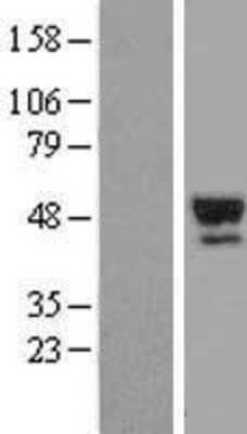 Western Blot: Serpin A7/TBG Overexpression Lysate [NBL1-15840]